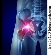 Hip Pain Hip Pain