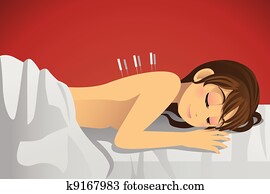 Acupuncture treatment