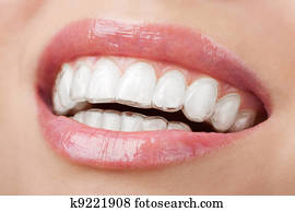 teeth with whitening tray teeth with whitening tray