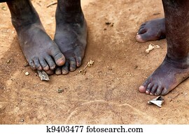 Feet Feet