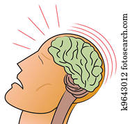 Concussion Concussion