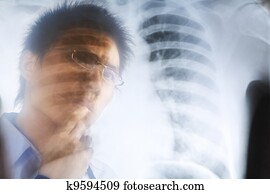 Asian doctor examining xray negative