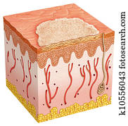 basal cell carcinoma basal cell carcinoma