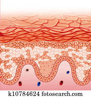 Darier skin disease Darier skin disease