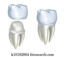dental, coroas, e, dente