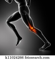 deportes, rodilla, lesión, radiografía, concepto