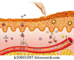 Dermatitis Dermatitis