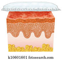 Diaper Rash Diaper Rash