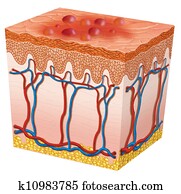 herpes herpes