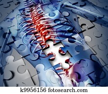 Human Back Disease Human Back Disease