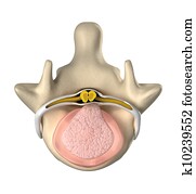 Intervertebral disc with pressure on spinal cord top view Intervertebral disc with pressure on spinal cord top view