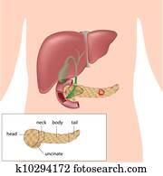 Pancreatic cancer, eps10 Pancreatic cancer, eps10