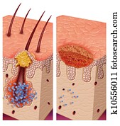 pathogenic bacteria pathogenic bacteria