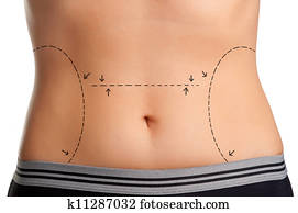 Plastic Surgery Plastic Surgery