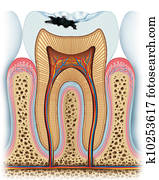 Principle of a cavity Principle of a cavity