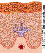 skin depigmentation skin depigmentation