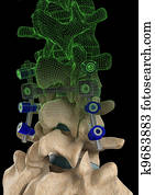 Spine Screws