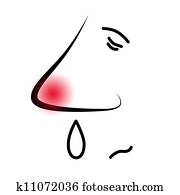 sujeito, com, a, gripe, ou, com, um, alergia