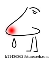 sujeito, com, a, gripe, ou, com, um, alergia