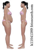 Weight Loss Before And After Side View Weight Loss Before And After Side View