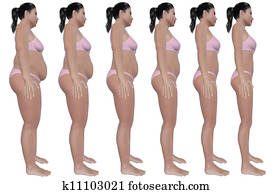 Weight Loss Progress Side View Weight Loss Progress Side View
