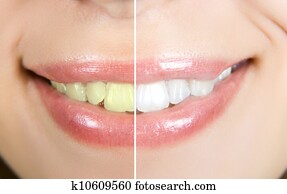 whitening whitening