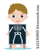 x ray bones kid x ray bones kid