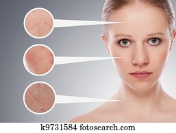 מושג, skincare., עור, של, יופי, אישה צעירה, לפני ואחרי, ה, פרוצדורה, ב, a, רקע אפור