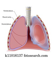 ריאה, קרום חזה, ו, פליאראל, חור