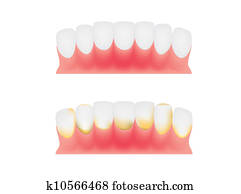 שיניים, ו, gums,, של השיניים, לוח