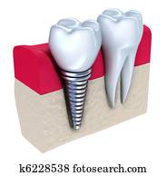 של השיניים, השרש