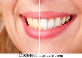 של השיניים, ללבון