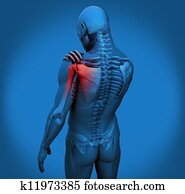 Digital figure with shoulder pain Digital figure with shoulder pain