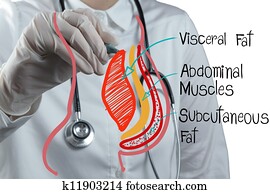 doctor draws abdominal fat doctor draws abdominal fat