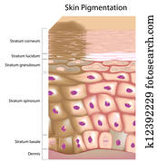 Formation of uneven skin tone Formation of uneven skin tone