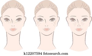 frau, mit, sommersprossen, leber befleckt