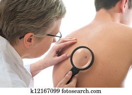 hautarzt, untersucht, a, maulwurf