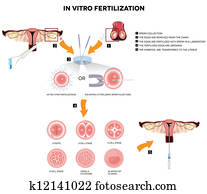 in-vitro düngung in-vitro düngung