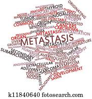 metastasis