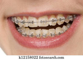 oral hygiene oral hygiene