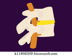 rückgrat, knochen, abschnitt rückgrat, knochen, abschnitt