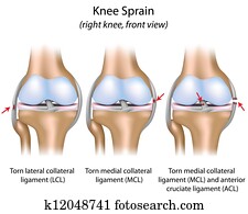 ברך, sprain,, eps8