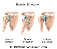 הזז, shoulder,, eps8
