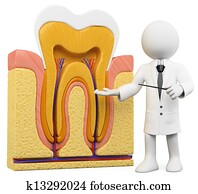 3D white people. Dentist with tooth section 
