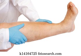 abaixar, membro, exame