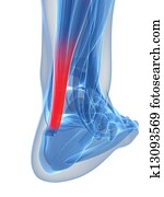 Achilles tendon Achilles tendon