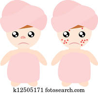 acné, es, enemigo, de, mujer