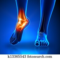ankel, כאב, -, כאב, טראומה