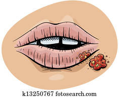 Cold Sore Cold Sore