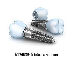 Dental implants , crown with pin Dental implants , crown with pin